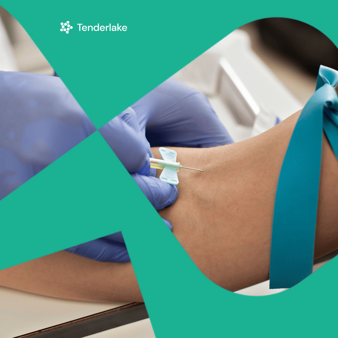 Procurement Opens for Next-Generation Plasma Virus Screening